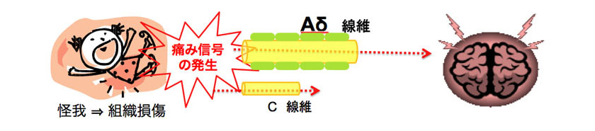 痛みを感じるしくみ