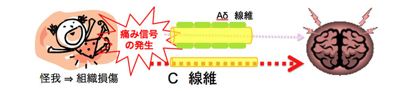 痛みを感じるしくみ