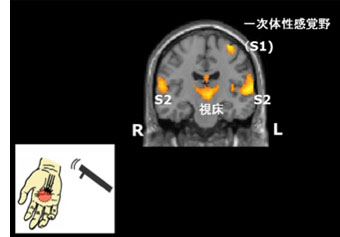 痛みを感じるしくみ